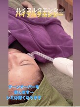 ティアラ(TIARA)/ニキビケアにオプション追加可能