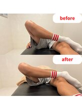 ナオル整体 福岡香椎院(NAORU整体)/40代男性施術事例【股関節】