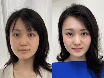 ウル 恵比寿渋谷店(ULU)/こんなに透明感が出るなんて！