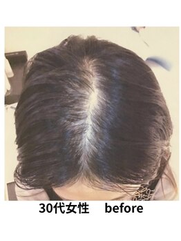 イーズ/リバイタ 梅田本店/【ケース2】 ３０代女性　before