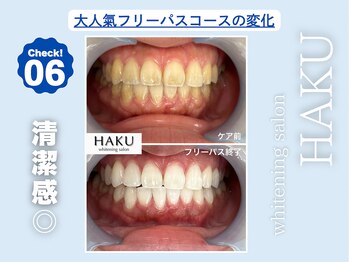 ハク 袋井磐田店(HAKU)/お客様before→after 6