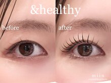 ミイン(miin)/アンドヘルシー