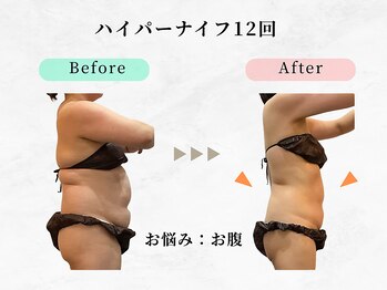 美容整体ウェリナ 中川八田院/小顔矯正/骨盤矯正/痩身整体