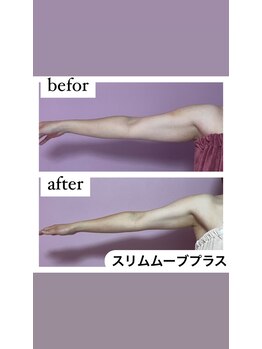 ビューティーサロンパピヨン 川口新井宿店/ビフォーアフター