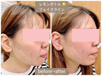 ルームエイトエイティスリー 新宿(R883)/脂肪分解！レモンボトル