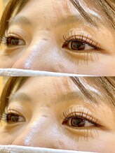 アイビューティートロント(i beauty Toronto)/持ちがいい◎ &healthy 140本