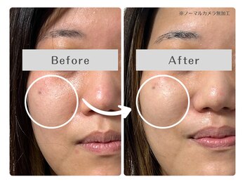 ルリアン(Lurian)/たった1回でキメ整う!