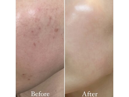 エクラ(eclat)の写真