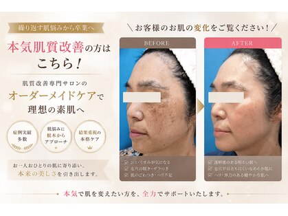 リセラ エン イズモ(recella en izumo)の写真