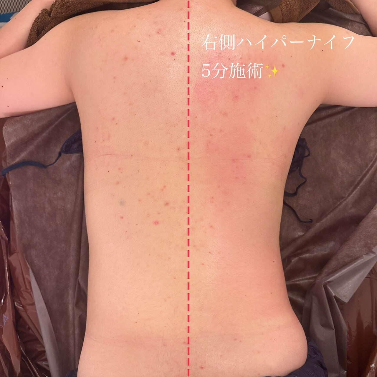 23ビューティー(23beauty)｜ホットペッパービューティー