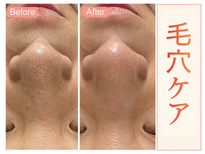 トレ(thore.)の写真