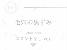 ラヴィオーラ 栄(LV)/ダイヤモンドハーブピーリング