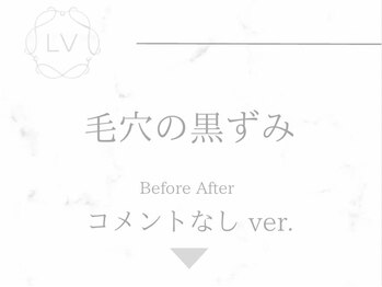 ラヴィオーラ 栄(LV)/ダイヤモンドハーブピーリング