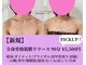 ビモテ 新宿代々木(BIMOTE)の写真/【挙式前のプレ花嫁さま必見！】ドレス映えする美姿勢へ！小顔矯正×骨盤矯正筋膜リリースで最高の美を◎