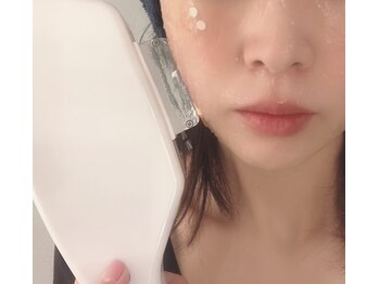 エンディミオン(Endymion)/脱毛＆光エステ効果2