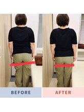 ナオル整体 三鷹院(NAORU整体)/40代女性施術事例【骨盤の高さ】