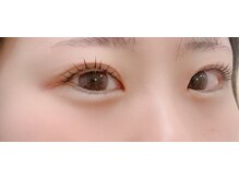 ビート(BEAT)/マツパ