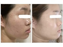 スリリアン 銀座/★お客さまビフォーアフター★