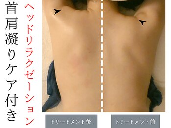 スナリ(SUNARI)/ヘッドスパ Before→After