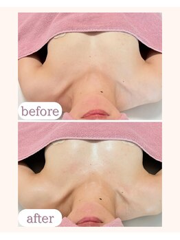 ワム(Wom)/固バストもマッサージで柔らかく