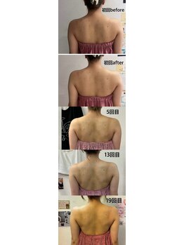 ロココ 豊田店(Rococo)/ビフォーアフター