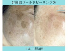 リメイク 広尾(REMAKE)/