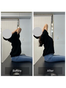 ナオル整体 姪浜院(NAORU整体)/Before/After　胸椎伸展