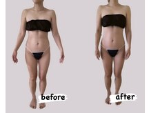 ミイン(miin)/全身コース（30代）［柏/miin］