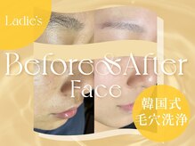 クリアラボ 錦糸町(Clear Lab)/韓国肌管理&毛穴洗浄専門店