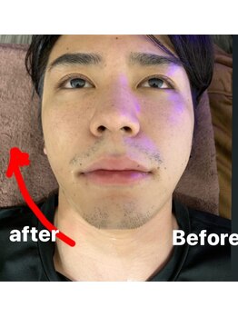 ルビー 新宿(Ruby)/効果に自信あり◎