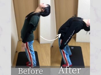 タケダ整体院/ダンサーの腰痛の改善事例
