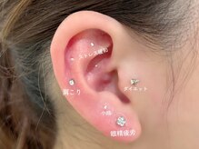 グローラ(GROWLA)/