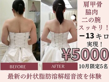 ウィズマツオカ 光の森店