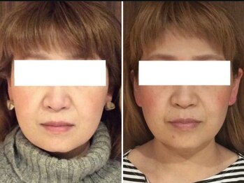 美容整体ウェリナ 名駅院/小顔矯正/骨盤矯正/美脚サロン