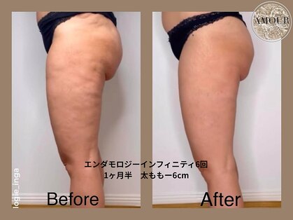 アムール 麻布十番(Amour)の写真