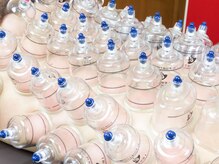 スロー(Slow)/疲労回復！本格韓国式カッピング