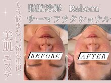 ティパニボーテ(Tipani Beaute')