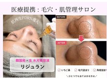 ユズドット(yuzu.)