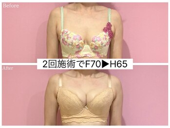 ククナ 新潟本店(KUKUNA)/*バストアップケア*