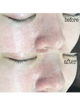 ラヴァン(LaVan)/復元磁気パック