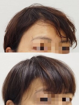 ナナラ(NANALA)/新発売!髪の元気になる!