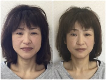 美容整体ウェリナ 中川八田院/小顔矯正/骨盤矯正/痩身整体