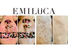 エミルカ 北谷店(EMILUCA)