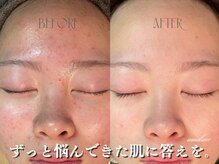 エステティック モンルーチェ(Esthetique monluce)