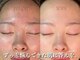 エステティック モンルーチェ(Esthetique monluce)の写真