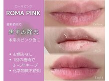 みや美