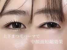 ビアンカ(Bianca)