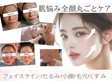 ティパニボーテ(Tipani Beaute')