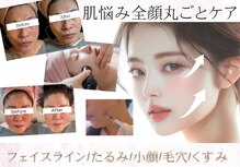 ティパニボーテ(Tipani Beaute')