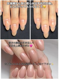 歪み解消3D美フォルム